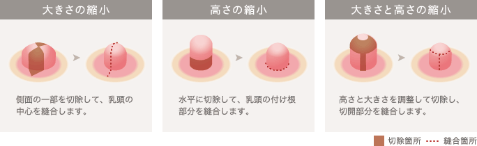 大きさの縮小