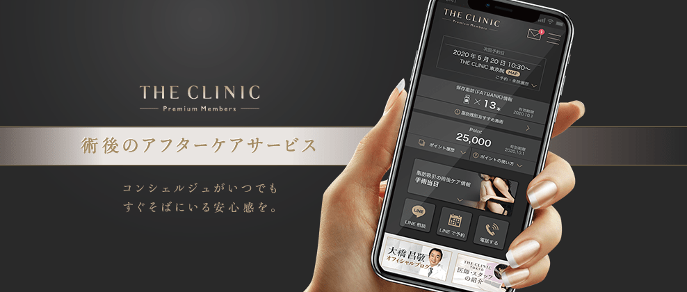 術後のアフターケアサービス