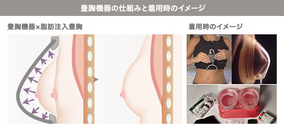 豊胸機器の仕組みと着用時のイメージ