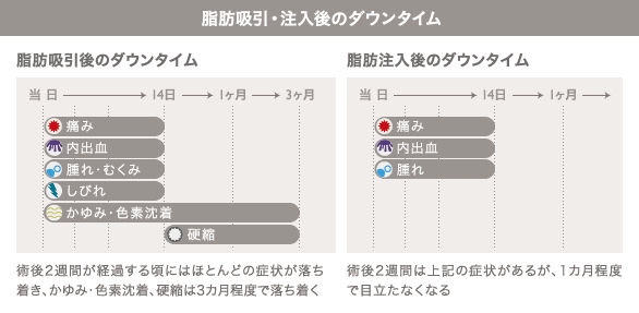 脂肪吸引、脂肪注入後のダウンタイム