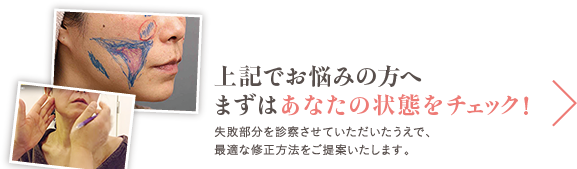 上記でお悩みの方へ まずはあなたの状態をチェック！ 失敗部分を診察させていただいたうえで、最適な修正方法をご提案いたします。
