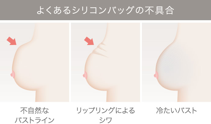 乳房再建リタッチ｜THE CLINIC （ザクリニック）【公式】