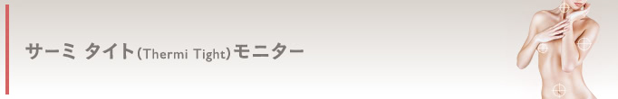 サーミタイト(たるみ改善)モニター1