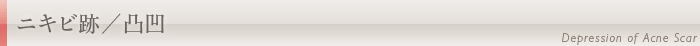 ニキビ跡/凸凹
