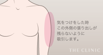 気をつけをした時 この外側の張り出しが 残らないように 吸引します。