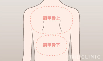 吸引範囲は肩甲骨上下の2箇所