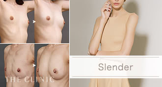 THE CLINIC(ザクリニック) の脂肪吸引が選ばれる理由: 痩せた方でも対応可能