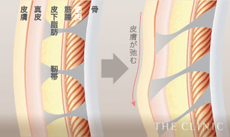 皮膚が弛む