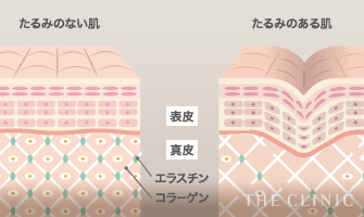 たるみのない肌 / たるみのある肌