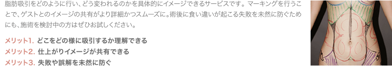 脂肪吸引をどのように行い、どう変われるのかを具体的にイメージできるサービスです。 マーキングを行うことで、ゲストとのイメージの共有がより詳細かつスムーズに。術後に食い違いが起こる失敗を未然に防ぐためにも、施術を検討中の方はぜひお試しください。 | メリット1. どこをどの様に吸引するか理解できる／メリット2. 仕上がりイメージが共有できる／メリット3. 失敗や誤解を未然に防ぐ
