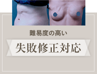 難易度の高い失敗修正対応