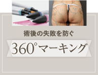 術後の失敗を防ぐ360°マーキング
