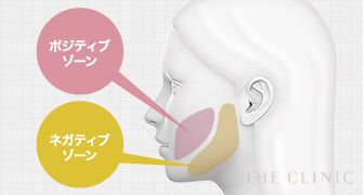 顔の脂肪吸引の取るべきゾーンと取ると失敗するゾーンの説明