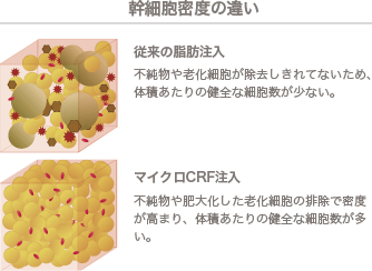 幹細胞密度の違い