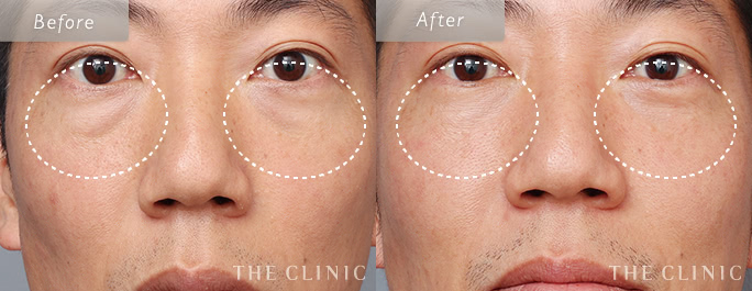 志田医師の症例写真