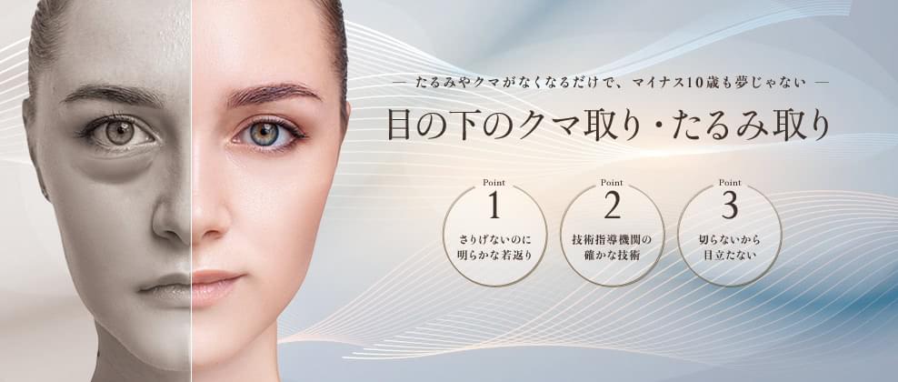 目の下のたるみ取り・クマ取り