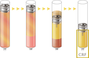 : 少量の脂肪を採取 / チュメセントを捨てる / ウェイトフィルターで不純物と健全な脂肪を分別 / 不純物を破棄 CRF > 幹細胞濃縮 > SRF / 大きな脂肪のみ粉砕し小さな脂肪と幹細胞のみ抽出 マイクロCRF