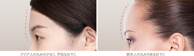 アジア人の丸みの少なく、平坦なおでこ / 欧米人の丸みのあるおでこ