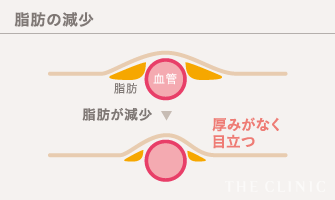 脂肪の減少：血管周りの脂肪が減少することで血管が目立つようになります