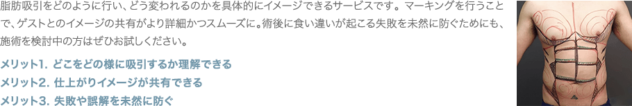 脂肪吸引をどのように行い、どう変われるのかを具体的にイメージできるサービスです。 マーキングを行うことで、ゲストとのイメージの共有がより詳細かつスムーズに。術後に食い違いが起こる失敗を未然に防ぐためにも、施術を検討中の方はぜひお試しください。 | メリット1. どこをどの様に吸引するか理解できる / メリット2. 仕上がりイメージが共有できる / メリット3. 失敗や誤解を未然に防ぐ