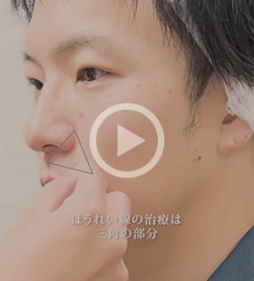 インタビュー動画