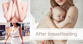 THE CLINIC（ザクリニック） の脂肪吸引が選ばれる理由: 授乳後の女性が数多くご来院