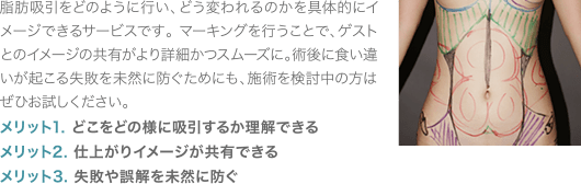 脂肪吸引をどのように行い、どう変われるのかを具体的にイメージできるサービスです。マーキングを行うことで、ゲストとのイメージの共有がより詳細かつスムーズに。術後に食い違いが起こる失敗を未然に防ぐためにも、施術を検討中の方はぜひお試しください。 メリット1. どこをどの様に吸引するか理解できる メリット2. 仕上がりイメージが共有できる メリット3. 失敗や誤解を未然に防ぐ