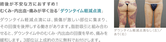 術後が不安な方におすすめ！むくみ・内出血・痛みが早く治る「ダウンタイム軽減点滴」 ダウンタイム軽減点滴には、損傷が激しい部位に集まり、その回復を後押しする働きがあります。脂肪吸引と組み合わせると、ダウンタイム中のむくみ・内出血の回復を早め、痛みを緩和します。 3部位以上成約の方に無料でお付けします。