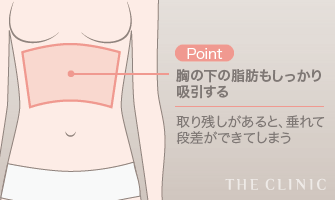 Point: 胸の下の脂肪もしっかり吸引する | 取り残しがあると、垂れて段差ができてしまう