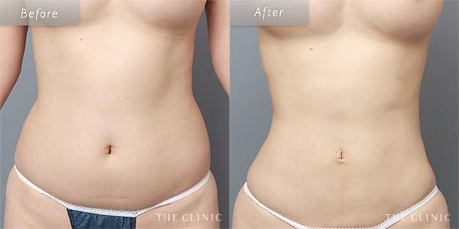 引き締まった“くびれ美人”に(33歳)