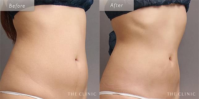 ただ細いだけじゃない、自然なくびれに(23歳)