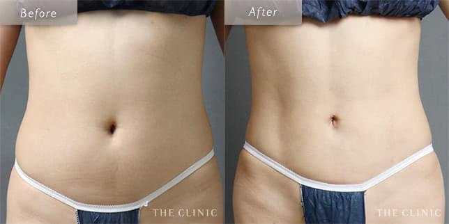 女性らしいメリハリボディに(33歳)