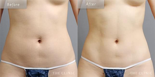 健康的な魅力溢れる美ボディ(27歳)