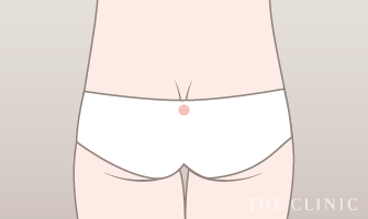 傷跡