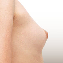 乳頭の調整