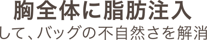 胸全体に脂肪注入して、バッグの不自然さを解消