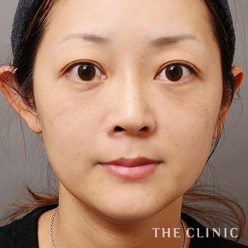症例 豊胸 脂肪吸引 エイジング治療のthe Clinic 公式