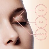 まぶた の 脂肪 吸引