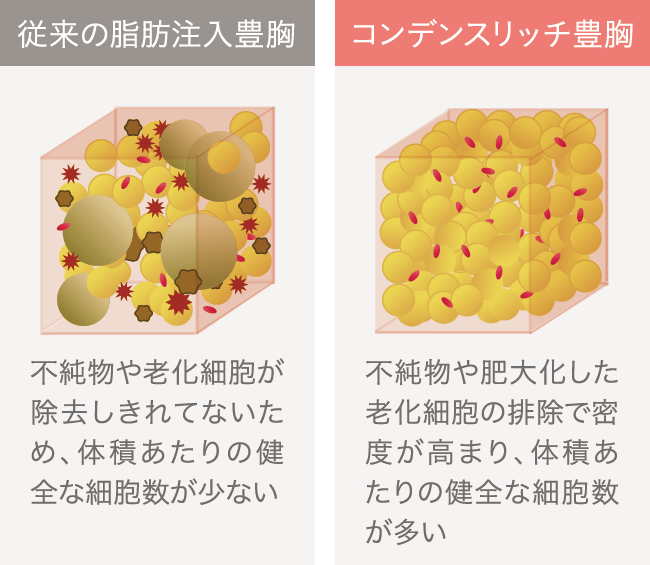 プレミアムハイブリッド豊胸｜THE CLINIC （ザクリニック）【公式】