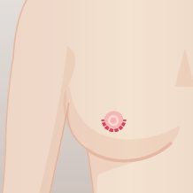 Ftmの胸オペ ボディデザイン The Clinic ザクリニック 公式