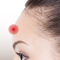 おでこ 額 のへこみ くぼみ改善 The Clinic ザクリニック 公式 おでこ 額 のへこみ くぼみ改善 The Clinic ザクリニック 公式