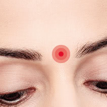 目の上のくぼみ 三重まぶた の改善 The Clinic ザクリニック 公式 目の上のくぼみ 三重まぶた の改善 The Clinic ザクリニック 公式