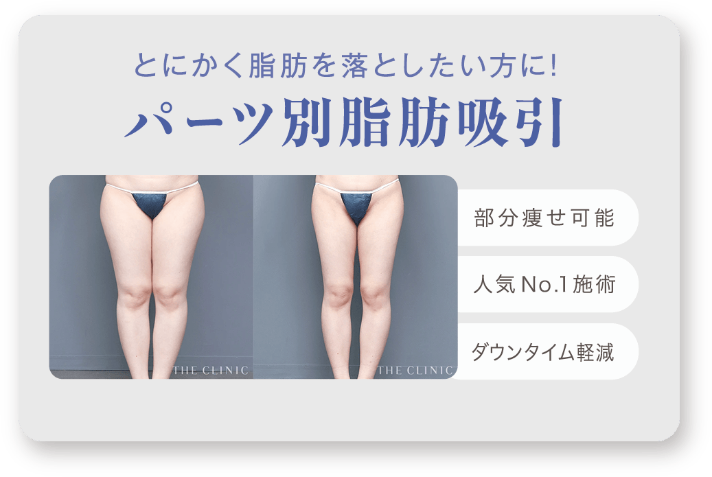 とにかく​脂肪を​落としたい方に！​ パーツ別脂肪吸引​​​