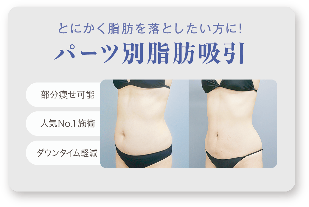 とにかく脂肪を落としたい方に！ パーツ別脂肪吸引