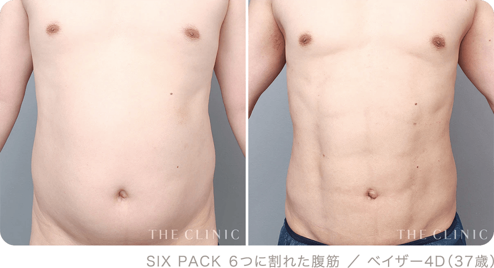 SIX PACK ６つに割れた腹筋 ／ ベイザー4D（37歳）