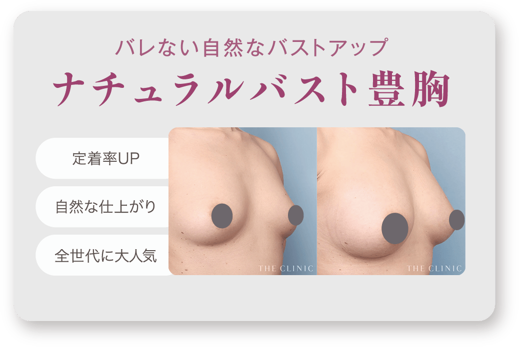 バレない​自然な​バストアップ ナチュラルバスト豊胸
