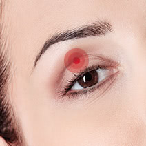 目の上のたるみ