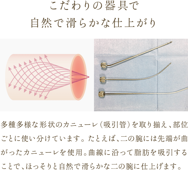こだわりの器具で自然で滑らかな仕上がり | 多種多様な形状のカニューレ（吸引管）を取り揃え、部位ごとに使い分けています。 たとえば、二の腕には先端が曲がったカニューレを使用。曲線に沿って脂肪を吸引することで、ほっそりと自然で滑らかな二の腕に仕上げます。