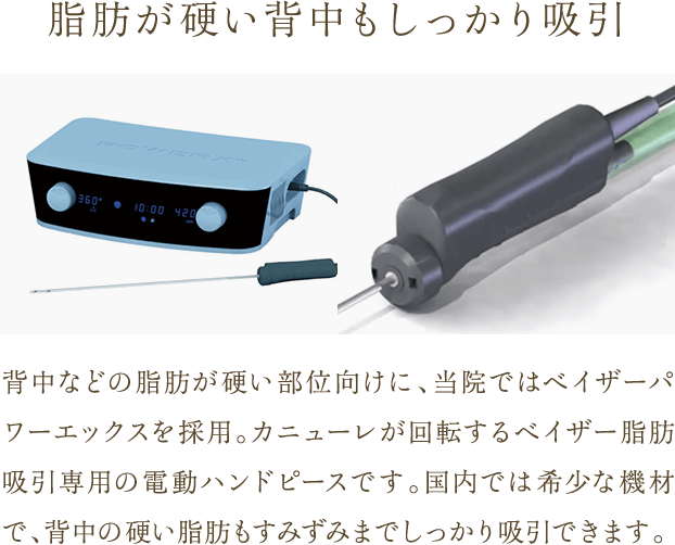 脂肪が硬い背中もしっかり吸引 | 背中などの脂肪が硬い部位向けに、当院ではベイザーパワーエックスを採用。カニューレが回転するベイザー脂肪吸引専用の電動ハンドピースです。国内では希少な機材で、背中の硬い脂肪もすみずみまでしっかり吸引できます。