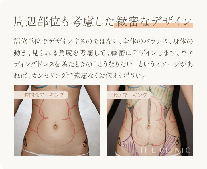 周辺部位も考慮した緻密なデザイン | 部位単位でデザインするのではなく、全体のバランス、身体の動き、見られる角度を考慮して、緻密にデザインします。ウエディングドレスを着たときの「こうなりたい」というイメージがあれば、カンセリングで遠慮なくお伝えください。